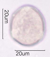 Purple deadnettle (Lamium purpureum) Pollen under the Microscope