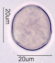 Purple deadnettle (Lamium purpureum) Pollen under the Microscope