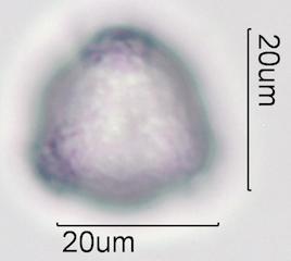 Purple deadnettle (Lamium purpureum) Pollen under the Microscope
