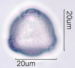Purple deadnettle (Lamium purpureum) Pollen under the Microscope