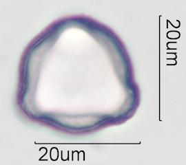 Purple deadnettle (Lamium purpureum) Pollen under the Microscope