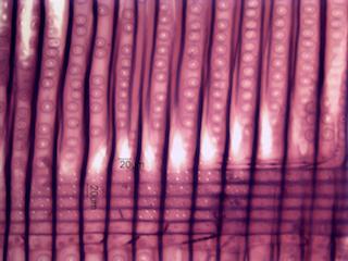 Larix laricina, Radial Section