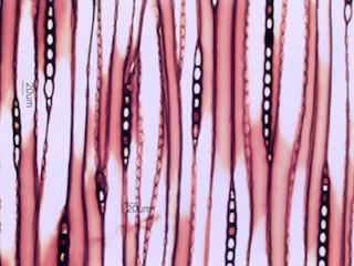 Larix laricina, Tangential Section