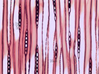 Larix laricina, Tangential Section