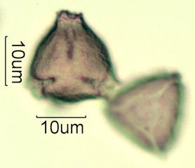 Australian Honey Pollen Under the Microscope