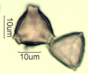 Australian Honey Pollen Under the Microscope