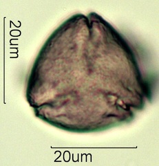 Australian Honey Pollen Under the Microscope