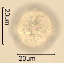 Lilac (Syringa vulgaris) Pollen Under the Microscope