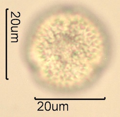 Lilac (Syringa vulgaris) Pollen Under the Microscope