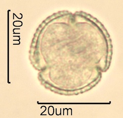 Lilac (Syringa vulgaris) Pollen Under the Microscope