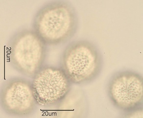 Lilac (Syringa vulgaris) Pollen Under the Microscope