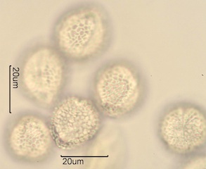 Lilac (Syringa vulgaris) Pollen Under the Microscope