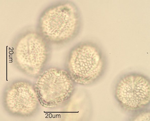 Lilac (Syringa vulgaris) Pollen Under the Microscope