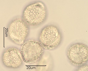 Lilac (Syringa vulgaris) Pollen