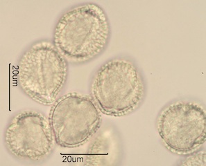 Lilac (Syringa vulgaris) Pollen Under the Microscope