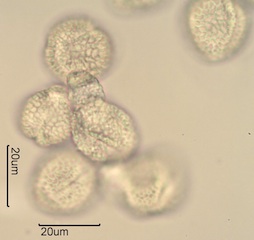 Lilac (Syringa vulgaris) Pollen Under the Microscope