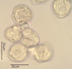 Lilac (Syringa vulgaris) Pollen Under the Microscope