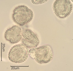 Lilac (Syringa vulgaris) Pollen Under the Microscope