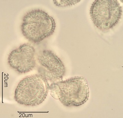 Lilac (Syringa vulgaris) Pollen Under the Microscope