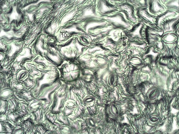 Stomata Under The Microscope