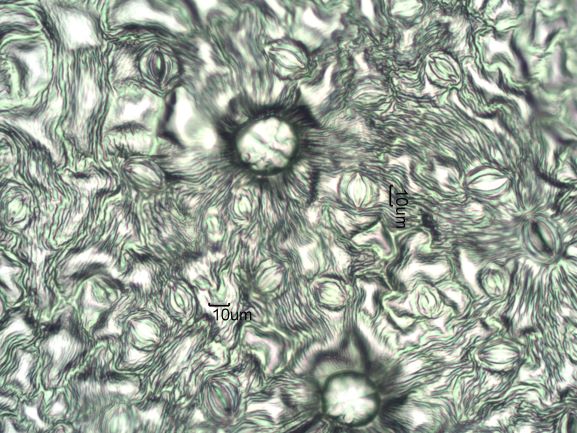 Stomata Under The Microscope