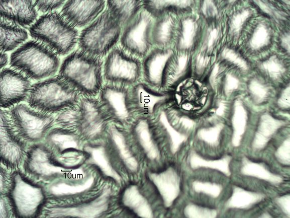 Stomata Under The Microscope