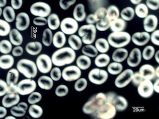 Lima Bean Starch