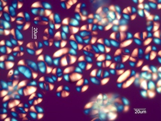 Lima Bean Starch Under the Microscope