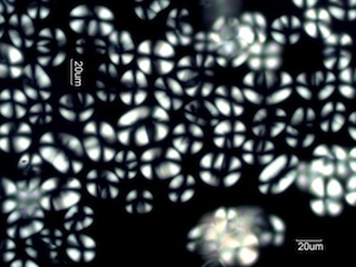 Lima Bean Starch Under the Microscope