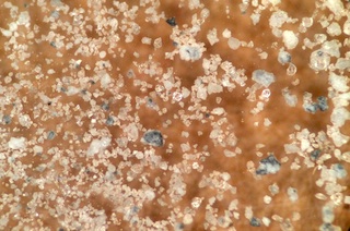 Aluminum Corrosion Debris