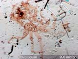 Louse