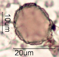Pollen found in Macadamia Honey