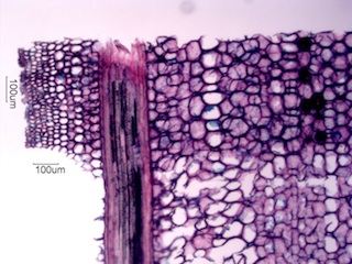Madake, Longitudinal Section