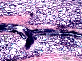 Madake Node, Longitudinal Section
