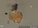 Insect Mandible