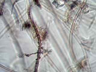 Leptothrix