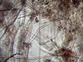 Leptothrix