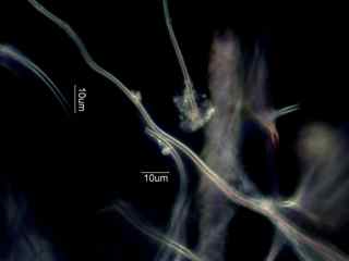 Leptothrix