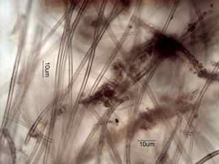 Leptothrix