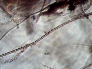 Leptothrix
