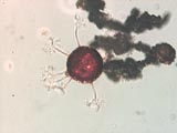 Microsphaera