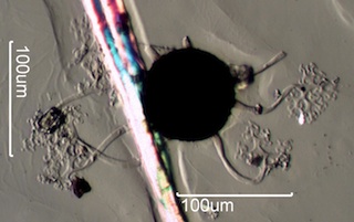 Microsphaera Under the Microscope