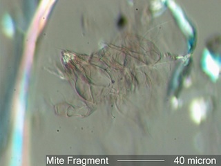 Mite Fragment