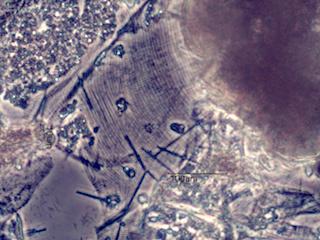 Mite Fragment