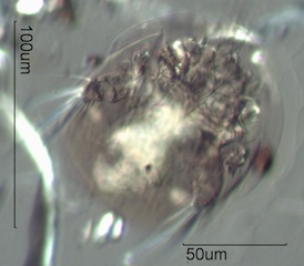 Oribata Mite