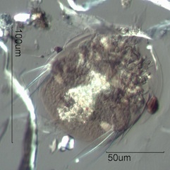 Oribata Mite