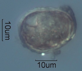Mite Egg