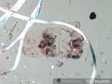 Mite in Household Dust