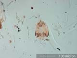 Tarsonemus Female Mite