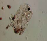 Mite